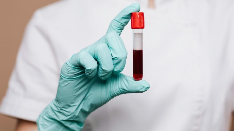 Ważność honorowego krwiodawstwa i działania siedleckich harcerzy na rzecz dzieci potrzebujących transfuzji